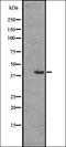 NRG-1 antibody, orb335524, Biorbyt, Western Blot image 