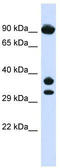 Cytochrome b-561 antibody, TA346309, Origene, Western Blot image 