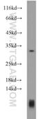 Ankyrin Repeat And SOCS Box Containing 17 antibody, 14146-1-AP, Proteintech Group, Western Blot image 