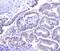 Hsp110 antibody, A04168, Boster Biological Technology, Immunohistochemistry paraffin image 