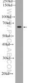 Fibroblast growth factor receptor substrate 2 antibody, 11503-1-AP, Proteintech Group, Western Blot image 