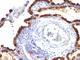 Keratin 7 antibody, V2659IHC-7ML, NSJ Bioreagents, Immunohistochemistry paraffin image 
