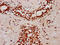Structural Maintenance Of Chromosomes 1B antibody, LS-C681400, Lifespan Biosciences, Immunohistochemistry paraffin image 