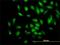 Phosphodiesterase 4D Interacting Protein antibody, H00009659-M01, Novus Biologicals, Immunocytochemistry image 