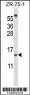 Small Ubiquitin Like Modifier 1 antibody, TA324522, Origene, Western Blot image 