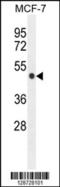 Zinc Finger Protein 454 antibody, 55-500, ProSci, Western Blot image 