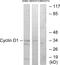 Cyclin D1 antibody, LS-C117867, Lifespan Biosciences, Western Blot image 