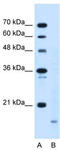 Peptidylprolyl Isomerase B antibody, TA335267, Origene, Western Blot image 
