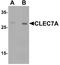 C-Type Lectin Domain Containing 7A antibody, A02731, Boster Biological Technology, Western Blot image 