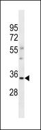 Olfactory Receptor Family 6 Subfamily S Member 1 antibody, LS-C158021, Lifespan Biosciences, Western Blot image 