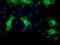 Protein Kinase C Epsilon antibody, NBP2-03620, Novus Biologicals, Immunocytochemistry image 