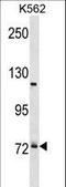 Pre-MRNA Processing Factor 39 antibody, LS-C155841, Lifespan Biosciences, Western Blot image 