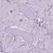 Coronin 1B antibody, HPA070456, Atlas Antibodies, Immunohistochemistry paraffin image 