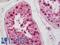 BRCA1-A complex subunit Abraxas antibody, LS-B11158, Lifespan Biosciences, Immunohistochemistry paraffin image 