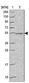 Abhydrolase Domain Containing 18 antibody, NBP2-30555, Novus Biologicals, Western Blot image 