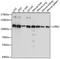 Phosphatidate phosphatase LPIN2 antibody, A05628, Boster Biological Technology, Western Blot image 