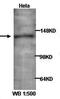 Adaptor Related Protein Complex 3 Subunit Delta 1 antibody, orb77092, Biorbyt, Western Blot image 