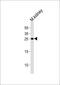 Claudin 6 antibody, M08182-1, Boster Biological Technology, Western Blot image 