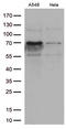 Zinc finger protein with KRAB and SCAN domains 1 antibody, LS-C795692, Lifespan Biosciences, Western Blot image 