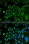 TAR DNA Binding Protein antibody, orb49083, Biorbyt, Immunocytochemistry image 
