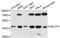 Ubiquitin Like Domain Containing CTD Phosphatase 1 antibody, LS-C748762, Lifespan Biosciences, Western Blot image 