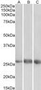 Peroxisomal Biogenesis Factor 5 antibody, 43-703, ProSci, Western Blot image 