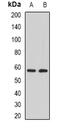 Protein Phosphatase 3 Catalytic Subunit Gamma antibody, abx142165, Abbexa, Western Blot image 