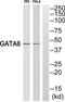 GATA Binding Protein 6 antibody, TA312214, Origene, Western Blot image 