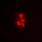 Mitogen-Activated Protein Kinase Kinase 1 antibody, LS-C352750, Lifespan Biosciences, Immunofluorescence image 
