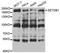 Histone-lysine N-methyltransferase SETDB1 antibody, TA332979, Origene, Western Blot image 