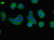 Bardet-Biedl Syndrome 1 antibody, orb47143, Biorbyt, Immunofluorescence image 