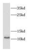 Stefin-B antibody, FNab02180, FineTest, Western Blot image 