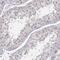 Purine Nucleoside Phosphorylase antibody, PA5-51616, Invitrogen Antibodies, Immunohistochemistry frozen image 