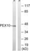 Peroxisomal Biogenesis Factor 10 antibody, LS-C120207, Lifespan Biosciences, Western Blot image 