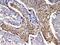 Actinin Alpha 3 (Gene/Pseudogene) antibody, PB10026, Boster Biological Technology, Immunohistochemistry paraffin image 