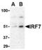 Interferon Regulatory Factor 7 antibody, TA306354, Origene, Western Blot image 