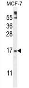 Zinc Finger Protein 720 antibody, AP54715PU-N, Origene, Western Blot image 
