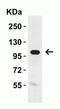 Klotho antibody, NBP1-76511, Novus Biologicals, Western Blot image 