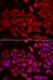 Threonyl-TRNA Synthetase antibody, LS-C334979, Lifespan Biosciences, Immunofluorescence image 