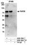 Terminal Nucleotidyltransferase 4B antibody, A305-160A, Bethyl Labs, Immunoprecipitation image 
