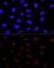 Probable rRNA-processing protein EBP2 antibody, GTX66557, GeneTex, Immunofluorescence image 