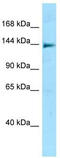 NLR Family CARD Domain Containing 5 antibody, TA342964, Origene, Western Blot image 
