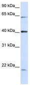 Spectrin Repeat Containing Nuclear Envelope Family Member 4 antibody, TA335982, Origene, Western Blot image 