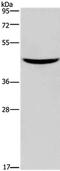 Gastric Inhibitory Polypeptide Receptor antibody, PA5-50611, Invitrogen Antibodies, Western Blot image 