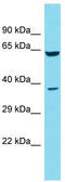 Doublecortin Domain Containing 2B antibody, TA335917, Origene, Western Blot image 