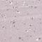 Carnitine O-palmitoyltransferase 1, brain isoform antibody, HPA063621, Atlas Antibodies, Immunohistochemistry frozen image 