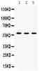 Chaperonin Containing TCP1 Subunit 4 antibody, PB9927, Boster Biological Technology, Western Blot image 