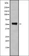Ubiquilin 4 antibody, orb378219, Biorbyt, Western Blot image 