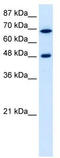 Ribosomal RNA Processing 9, U3 Small Nucleolar RNA Binding Protein antibody, TA345895, Origene, Western Blot image 