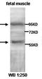 ATP Binding Cassette Subfamily E Member 1 antibody, orb76994, Biorbyt, Western Blot image 